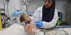 (يونيسف): 112 طفلاً يدخلون دائرة سوء التغذية يومياً في قطاع غزة