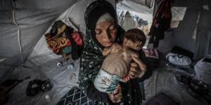 غزة: وفاة مواطنين نتيجة المجاعة وسوء التغذية خلال الساعات الـ24 الماضية
