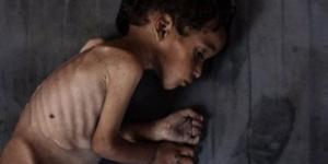 "الصحة" بغزة: ثمانية وفيات نتيجة المجاعة وسوء التغذية خلال الـ24 ساعة الماضية