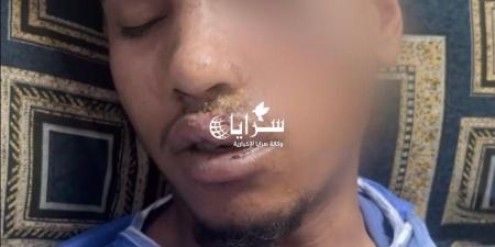 أُجبر على التنازل والمستشفى طرده ..  مأساة عامل وطن تعرض للدهس في الرصيفة