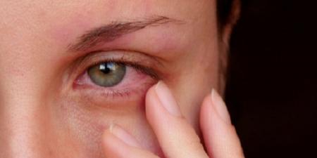 كيف تؤثر الهرمونات على صحة عينيك؟ تفاصيل قد تُفاجئك