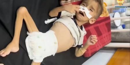 أطفال غزة معرضون للموت جوعاً