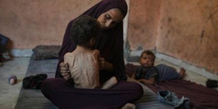 (أوتشا): تفاقم المجاعة وسوء التغذية وأزمة المأوى في قطاع غزة