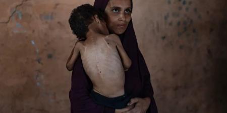 الأمم المتحدة تعلن رسمياً تفشي المجاعة بغزة