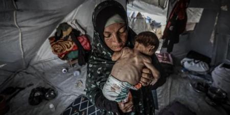 غزة: ثلاث وفيات نتيجة المجاعة وسوء التغذية خلال الـ 24 ساعة الماضية
