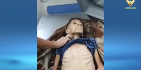 المجاعة في غزة تفتك بالمزيد من أبناء قطاع غزة