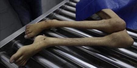 ارتفاع عدد وفيات التجويع الإسرائيلي بغزة إلى 303 فلسطينيين
