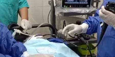 «حميات منوف» تنقذ مرضى الجلطات بطريقة حديثة دون جراحة
