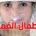 تونس: 5تلاميذ من أطفال القمر يجتازون امتحانات الباكالوريا