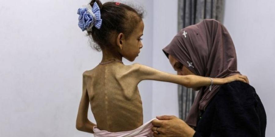 الأمم المتحدة: وفاة 8 أشخاص في غزة خلال 24 ساعة بسبب سوء التغذية