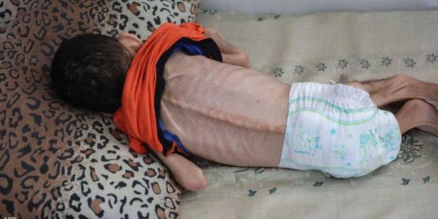 مسؤولة أوروبية: المجاعة في غزة حقيقية ويجب على إسرائيل السماح بوصول المساعدات
